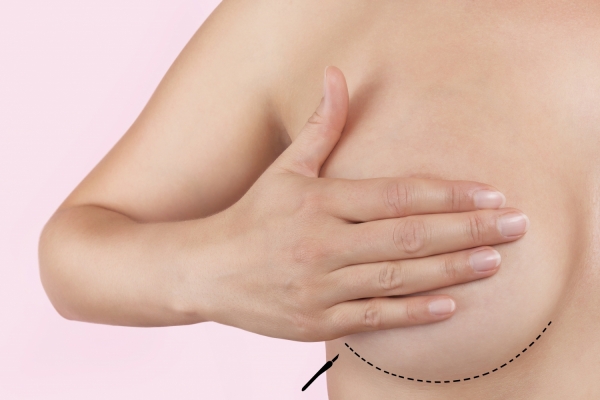 breast augmentation scarring plastic surgery South Carolina Georgia 